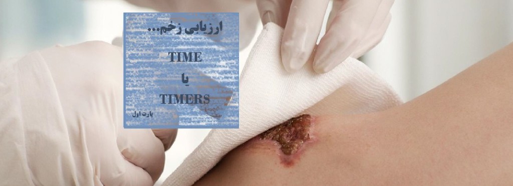 درک کامل زخم...TIME یا TIMERS ؟!!