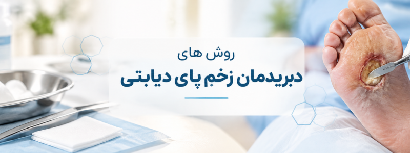 مقایسه روش‌های دبریدمان در زخم پای دیابتی | تهران ترمیم