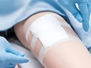 عوامل موثر بر بهبود زخم