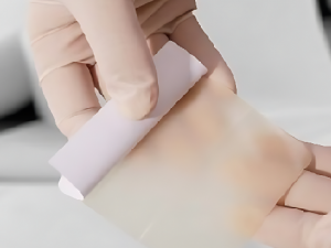 پانسمان هیدروکلوئیدچیست؟ (مطلب)