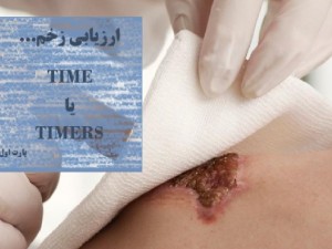درک کامل زخم...TIME یا TIMERS ؟!!