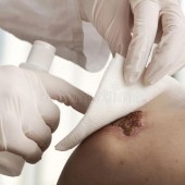 زخم و درمان ها