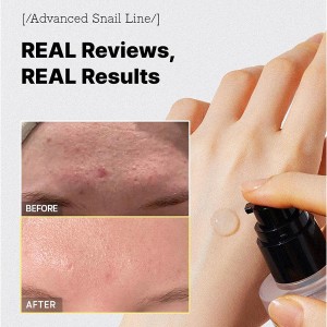 سرم آبرسان و ترمیم‌کننده و ضد پیری حلزون کوزارکس مدل Advanced Snail 96 Mucin Power Essence حجم 100 میل