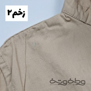 زیبای زخمی ۱