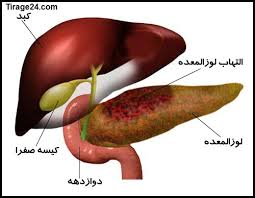 طبیعی ترین راه ها برای مقابله با مشکل کبد چرب