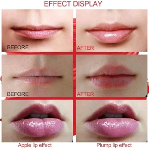 دستگاه حجم دهنده لب مدل Lip EGR