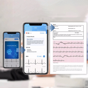 فروش دستگاه فشار خون و نوار قلب هوشمند