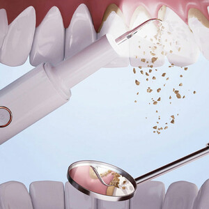 جرمگیر دندان شیائومی