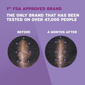 فوم ماینوکسیدیل 5% روگین مخصوص بانوان ( تک عددی و پک دو عددی)