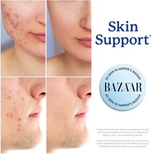 مکمل DM200mg + بیوپرین برند sm nutrition ساخت آمریکا 60 عددی SMNutrition DIM + BioPerine 200 mg 60 Capsules