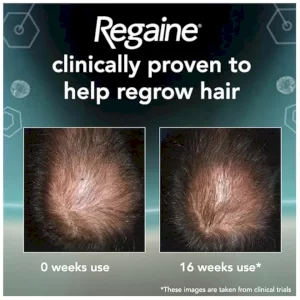 فوم ماینوکسیدیل آقایان 5% ریگین Regaine for men