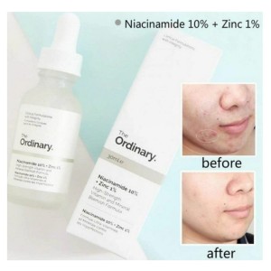 سرم ضد جوش نیاسینامید 10% + زینک 1% اوردینری اصل حجم 30 میلی لیتر  The Ordinary Niacinamide 10% + Zinc 1%