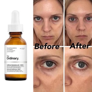 سرم دورچشم ضد تیرگی و پف کافئین اوردینری اصل حجم 30 میل The Ordinary Caffeine Solition 5%+EGCG