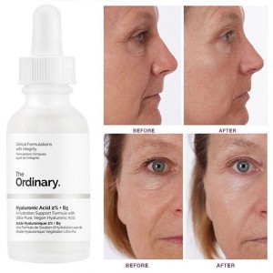 سرم آبرسان هیالورونیک اسید اوردینری حجم 30 میل The Ordinary Hyaluronic Acid 2% + B5