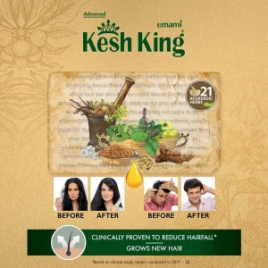 روغن ضد ریزش مو برند کش کینگ 100 میل Kesh King Kesh King Ayurvedic Scalp and Hair Oil