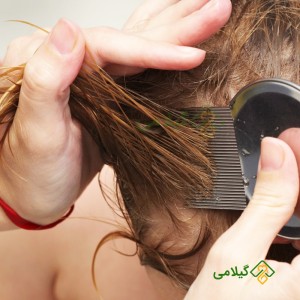 محصولات ضد شپش موی سر