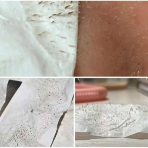 چسب لیفت صورت و شقیقه اصلی