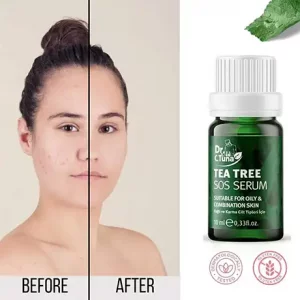 سرم ضد جوش تی تری دکتر سی تونا فارماسی Farmasi Dr. C. Tuna Tea Tree SOS Serum