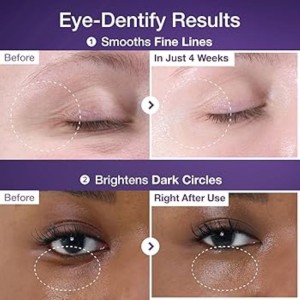 کرم دور چشم نامبوزین شماره 9 با ترکیب رتینول و NAD+