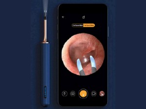 گوش پاک کن هوشمند شیائومی Xiaomi Bebird Note 3 Pro 3 in 1 multifunctional earwax removal