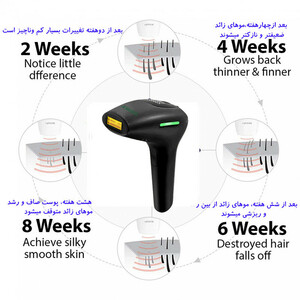 لیزر موهای زائد بانوان ایکسول مدل S-550