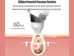 دستگاه پاک کننده جوش سرسیاه شیائومی Xiaomi Youpin Meishi Visible Nose Blackhead Remover GOODtime