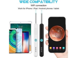 دستگاه آندوسکوپی و پاک کننده داخل گوش شیائومی Xiaomi Bebird R1 Smart Visual Ear Sticks Endoscope