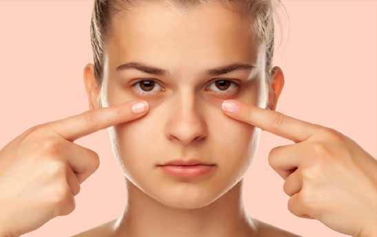 راه های رهایی از حلقه های تیره زیر چشم
