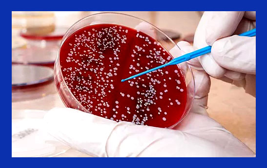 بیماریهای غیرواگیر؛ عامل مرگ سالی ۴۱ میلیون نفر در جهان