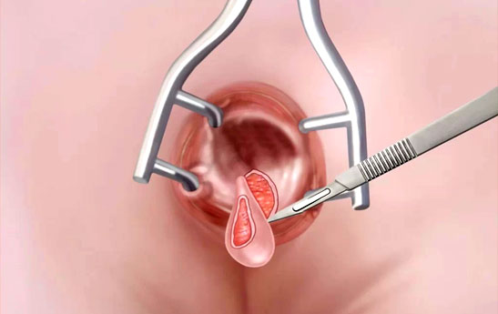 چگونگی انجام جراحی شقاق