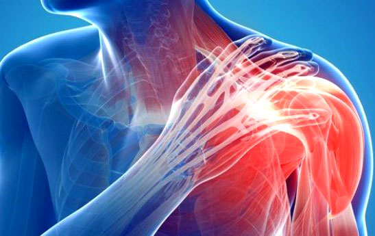 دلایل و راهکارهای درمان درد مفصل شانه، کتف و بازو