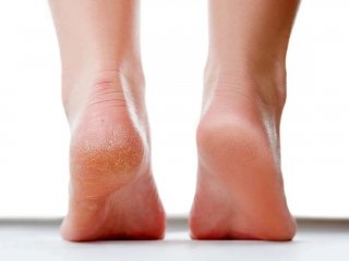 اثر کمبود ویتامین بر پا +  اینفوگرافیک