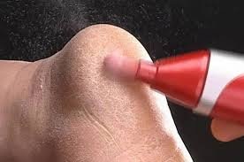 پینه و راه‌های مقابله با آن