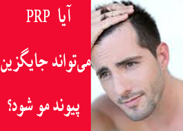 آیا  PRP  می‌تواند جایگزین پیوند مو شود؟