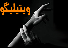 تكنيك‌های جراحی در درمان ويتيليگو