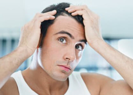 دلايل ريزش مو در آقايان