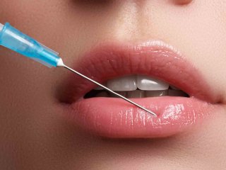 حقایقی ناگفته در مورد تزریق ژل لب!