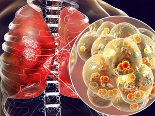 چرا پاسخ بدن افراد به ویروس کووید-۱۹ این‎ قدر متفاوت است؟