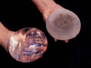 انواع پروتز سینه و کاربرد آنها