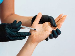 تزریق بوتاکس برای عرق کف دست