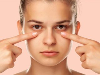 راه های رهایی از حلقه های تیره زیر چشم