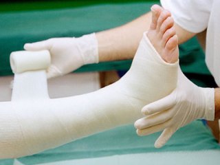 این افراد بیشتر در معرض خطر شکستگی استخوان هستند