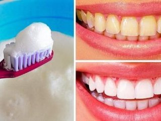 روش‌های طبیعی سفید کردن دندان‌ها
