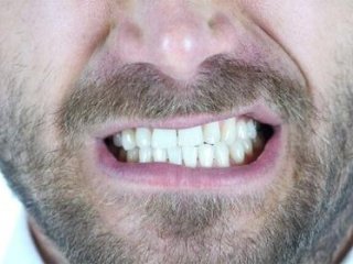 کمبود کدام ویتامین باعث پوسیدگی دندان می‌شود؟