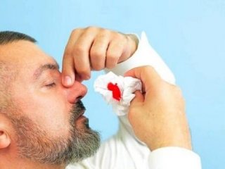 علت خون‌ریزی بینی در افراد چیست؟