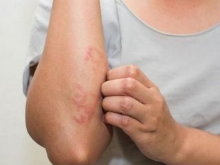 بهبود بیماری‌های پوستی با مصرف این نوع سرکه
