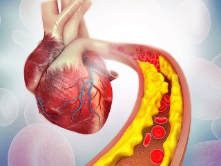 کاهش کلسترول خون با مصرف یک داروی گیاهی