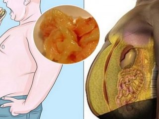 از بین بردن چربی شکمی با قهوه !