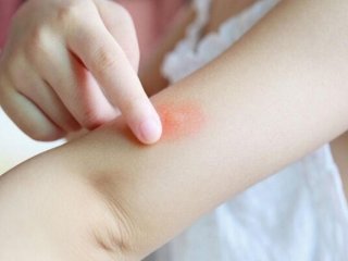 هشدار وزارت بهداشت درباره یک حشره خطرناک
