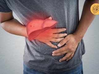 ۱۰ علامت و نشانه‌ ابتلا به کبد چرب